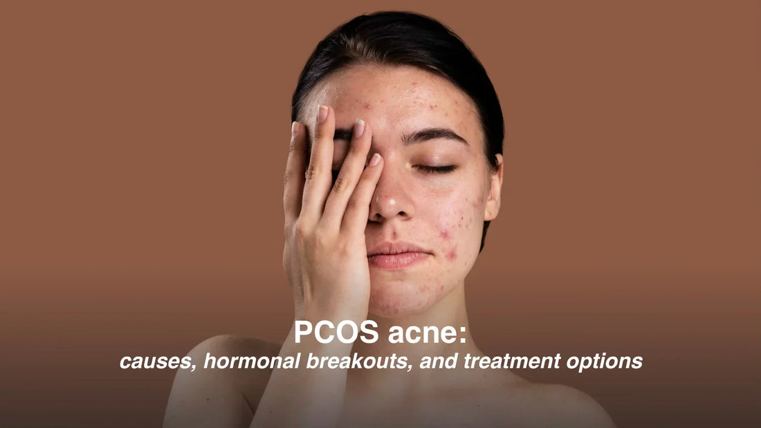 PCOS Acne: Causes, Hormonal Breakouts, and Treatment Options