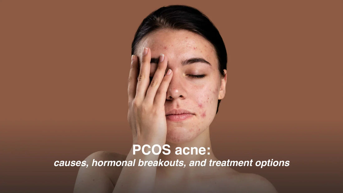 PCOS Acne: Causes, Hormonal Breakouts, and Treatment Options